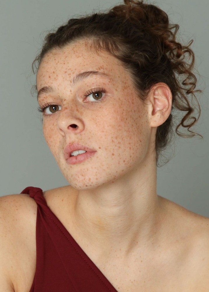 billie allen - profile